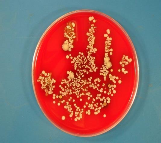 Hand Hygiene Hands of HCW s are the most common transmitter of disease in healthcare facilities A disease transmitted from a HCW to a patient is known as a Healthcare
