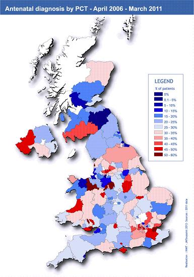 Figure 4. Much improved regional differences in antenatal detection of heart defects in Wales and in the rest of UK.