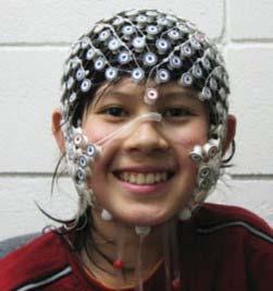 THE ELECTRODES This is how the circles (called electrodes) and wires will look on your head and in your hair.