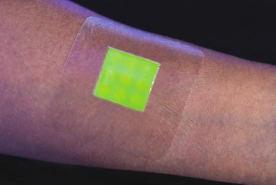 Transforming care Infectiondetecting bandages Latest laser at QVH eye unit Clinical trials of a smart bandage which changes colour when it detects infections are underway using samples from burns