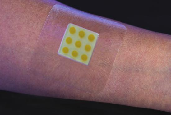 Swabs and used dressings from hundreds of patients are being tested in the laboratory to see how sensitive the bandages are to the infections they are designed to detect.
