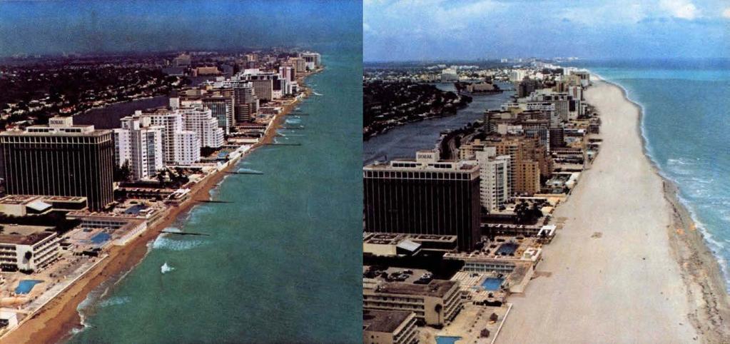 Economics & Return on Investment Before After Dade County Beach Erosion Control