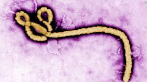 Mount Zion Mount Zion Intensive Care Unit (ICU) designated as Ebola Isolation Unit if necessary If a patient with suspected Ebola arrives at UCSF, the patient will be treated in the isolation unit at