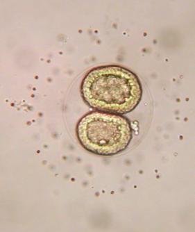 non-feeding larva of Littorina saxatilis has simple cilia;