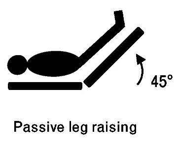 Stroke Volume Assessment using Passive Leg Raise (PLR) Obtain Stroke Volume This is a measured valve obtained invasively or noninvasively 1.
