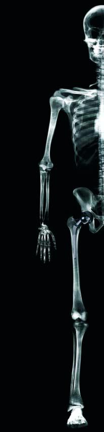 NHS Purchasing and Supply Agency s guidance on which hip prostheses meet National Institute for Clinical Excellence guidance should however mean that further improvements will be realised in due