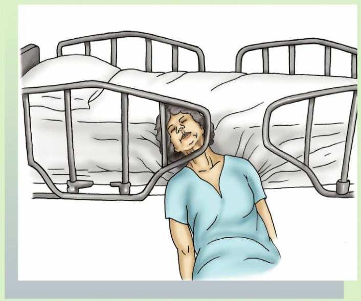 Appendix 1 Types of Entrapment Rail and off-bed entrapment: Most of the patient s body is off the bed,