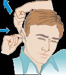 Administering Ear drops: For children fewer than 3 years of age, pull the ear down and back. For children over 3 years of age and adults, pull the ear up and back.