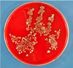 Hand Contamination from Environment Health Care Workers (HCWs) touched bedside rails and bedside tables for 5 seconds Hand imprint cultures were performed 53% of the HCWs hand cultures grew MRSA