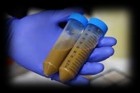Collection of Samples for Lab Testing Prompt identification of CDI is important for rapid initiation of appropriate treatment, and for timely application of infection control interventions.