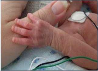 CLABSI PI Initiative in the Neonatal ICU NICU Quality Improvement Committee NICU Medical Director Infection Preventionist NICU nurses Nurse Educator Nurse Manager Physicians (attendings, fellows and