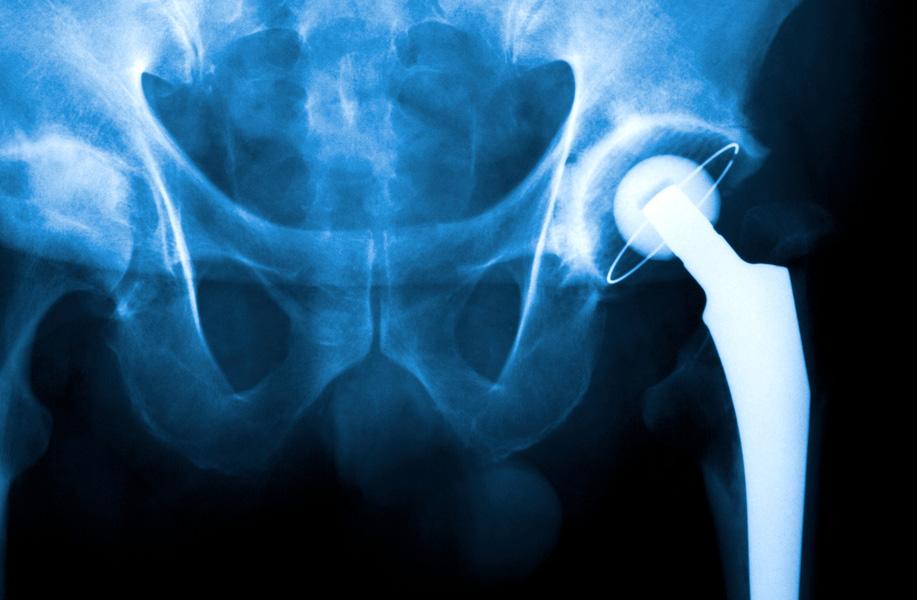 CORE CERTIFICATIONS Core Hip and Core Knee Replacement Certifications Orthopedic joint replacement programs