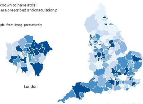 Make variation transparent and do something about it Using national and regional data to effect change: NHS Atlas of Variation
