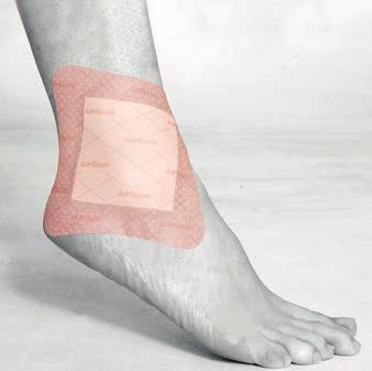 WOUND CARE designed to create an optimum moist environment at the wound bed and include the following types: Alginates: absorbent wound care dressings that contain sodium and calcium fibres derived