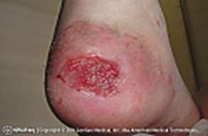 Look for signs of infection (redness around the