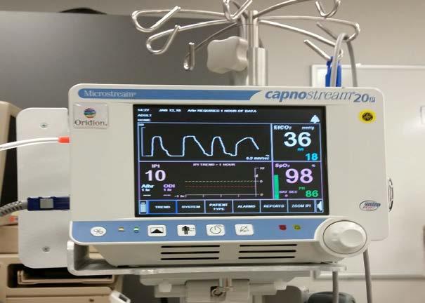 Distribution of Parameter Notifications to Study Patient D/C Time to D/C Capnography Min (hours) 2.9 Ave (hours) 22.3 Max (hours) 74.