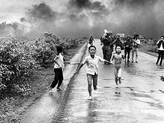 9 year old Kim Phuk was burned by American Napalm.