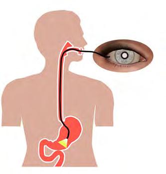 What is a Gastroscopy?