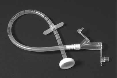 PEG Tube What is a PEG tube? A PEG tube is a type of feeding tube. It is inserted (put in) by a GI specialist (gastroenterologist) at the Endoscopy Unit.