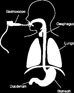 What is a Gastroscopy? A Gastroscopy is a look at your gullet, (called oesophagus ), stomach and first part of your small bowel (called duodenum ).