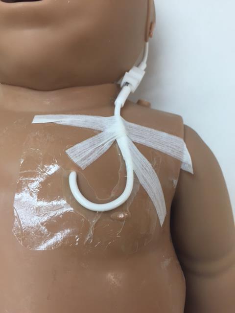 NICU Line Insertion Dressing Standards No Antimicrobial patch on babies under 28 weeks gestation.