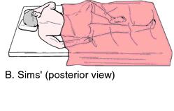 Sims position (semi-prone side position)