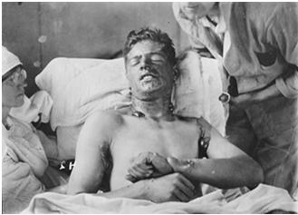 Mustard gas The Invisible Killer Carried by the wind Burned out soldier s