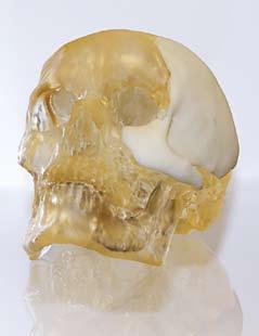 p The 3D Medical Applications Center provides physical anatomical models and cranioplasty implants using medical imaging data, and is