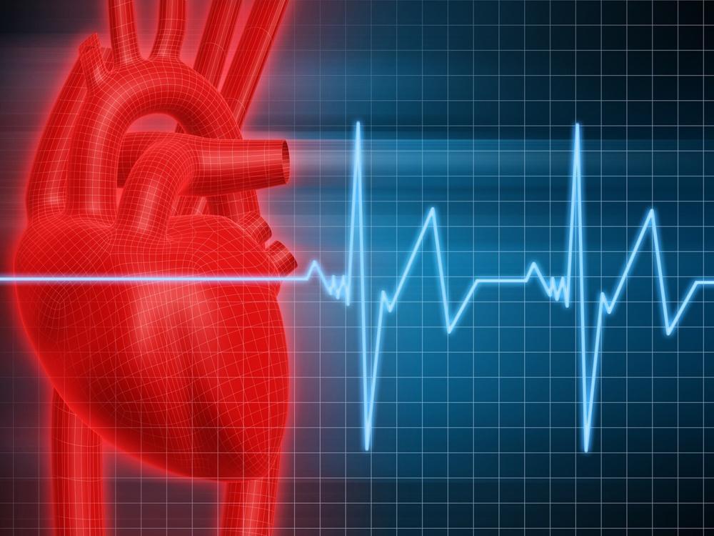 Standardized Performance Measures for Advanced Certification in Heart Failure Karen Kolbusz, RN,