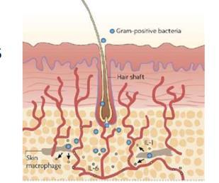 Where are the Pathogens? Pathogen source for most SSIs is endogenous flora of the patient s skin, mucous membranes or GI tract.