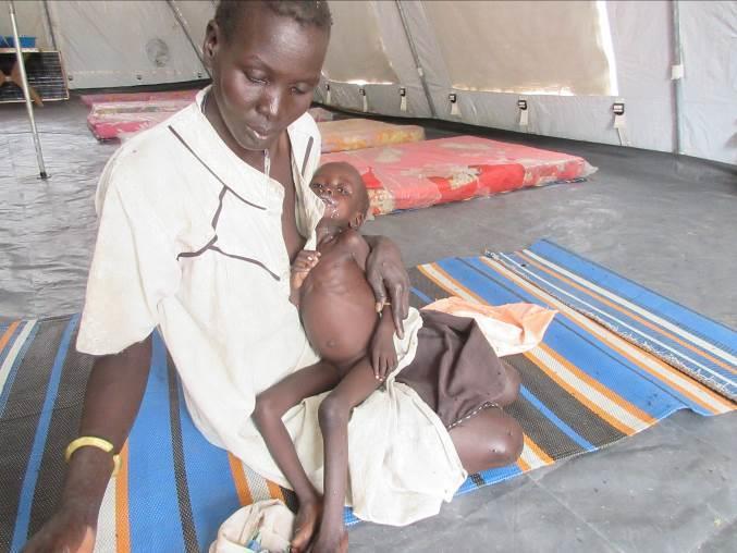 Severely acute malnourished child with medical