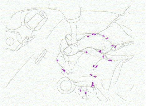 Hand transmission: Step 1 Organisms present on patient skin and environment surfaces Organisms (S. aureus, P. mirabilis, Klebsiella spp andacinetobacter spp.