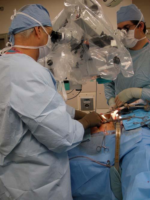 Traverso s operation: Pancreato-jejunostomy (duct-to-mucosa,