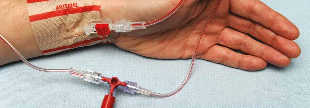 SAFETY, QUALITY AND EFFICIENCY WITHIN HOSPITALS Non-Injectable Arterial Connector (NIC) Maryanne Mariyaselvam Excellent idea. [I] feel confident this would benefit my family, myself and the NHS.