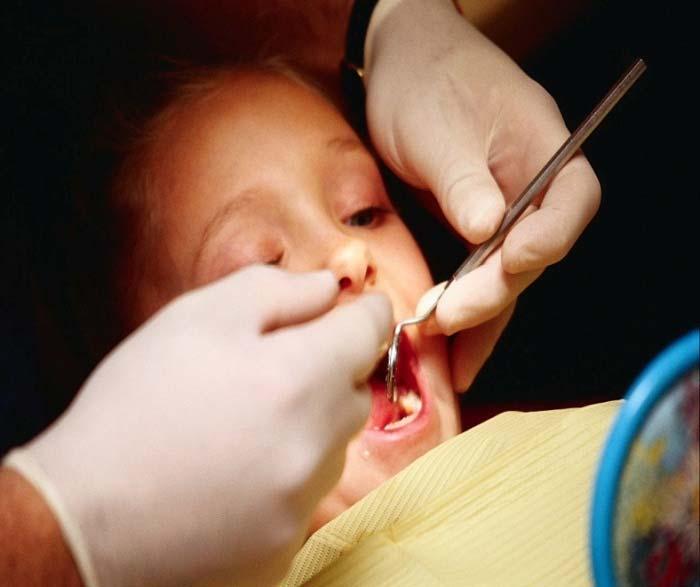 Dental Screening Emphasize importance of preventive dental health care Birth through 2 years: Screen for normal growth and development of the dentition