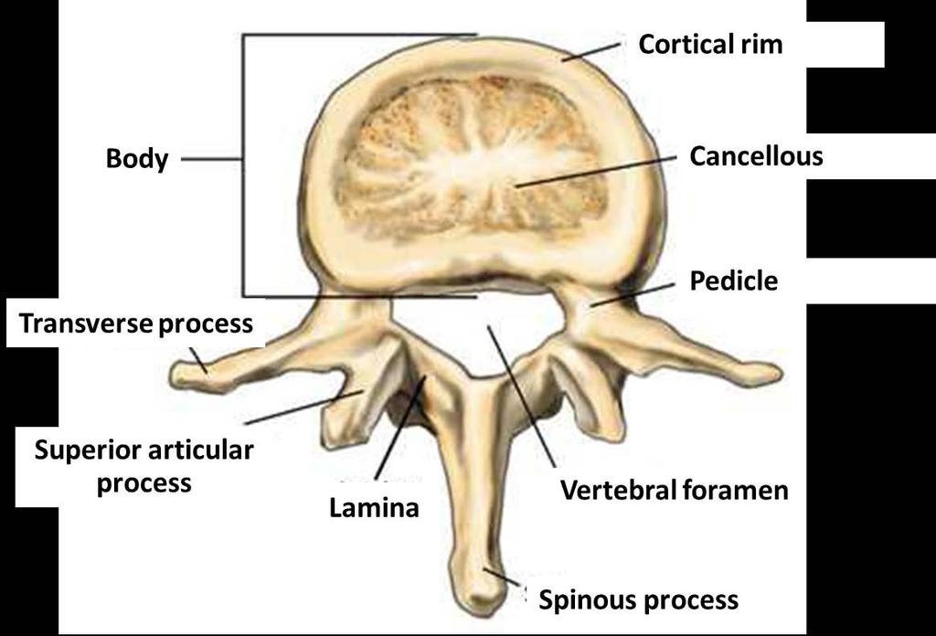 23 8% 7% 10% 11% 29% 35% Why Surgical Intervention Narrowing of the spinal canal, resulting in crowding of the nerve roots in the canal To relieve