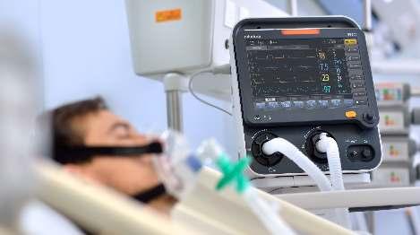 Comprehensive - SV300 comes with extensive ventilation modes and ideally suited for ICU use Simple - intuitive user interface that