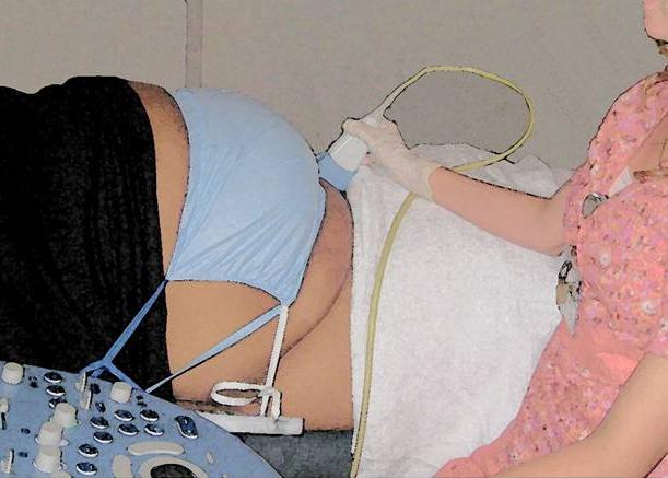 Bariatric Abdominal Support Sling Tasks Ultrasound Wound care Bathing Bedside