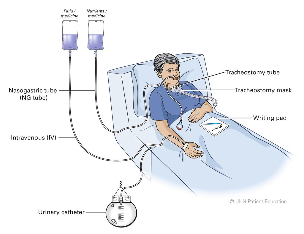 What can I expect after the surgery? 1. We take you to the Patient Anesthetic Care Unit (PACU) or recovery room. 2.