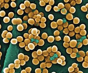 Staphylococcus aureus and other skin and soft tissue infections among basic military trainees, Lackland Air