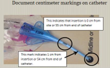 site or the external length of the catheter (exposed catheter from hub to insertion site) This assures that the catheter has not moved in or out at the insertion site o If more than 2 cm