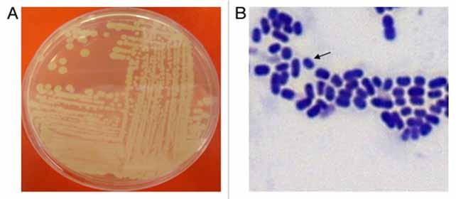 An outbreak of multidrug-resistant Acinetobacter baumannii Outbreak : controlled by