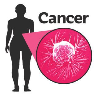 A doctor or nurse might ask if you have been checked for cancer: Cervical cancer check (for women who are