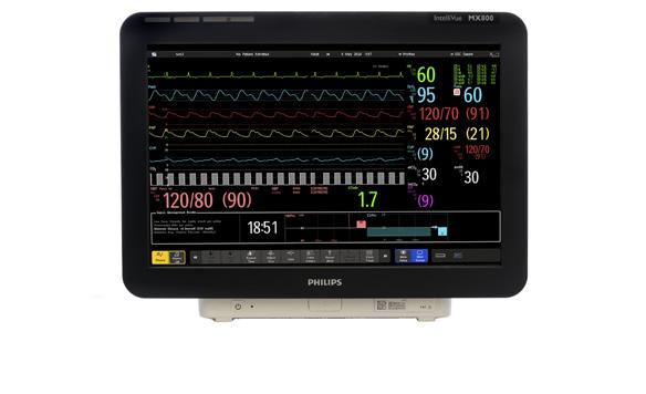 Fitting seamlessly into the IntelliVue family of solutions, the Philips IntelliVue MX800 is designed to simplify access to the patient information you need to enhance diagnostic confidence throughout