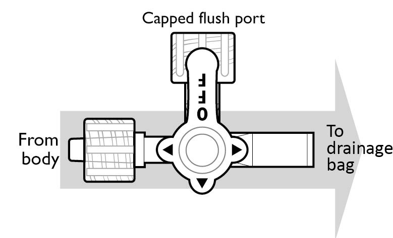 Inject the amount of fluid (most times about 10 cc) your doctor told you to use. Then turn the switch so it points to the flush port again (see drawing below).