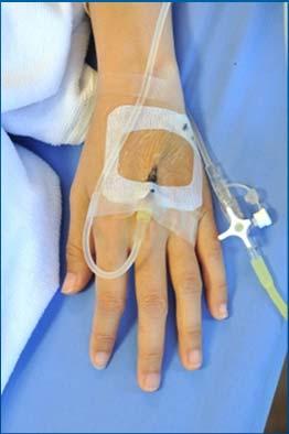 Intravenous (IV) Medication Use Essential component of care Clinically