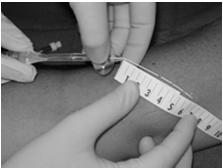 measurement with recorded external catheter length Concern is catheter