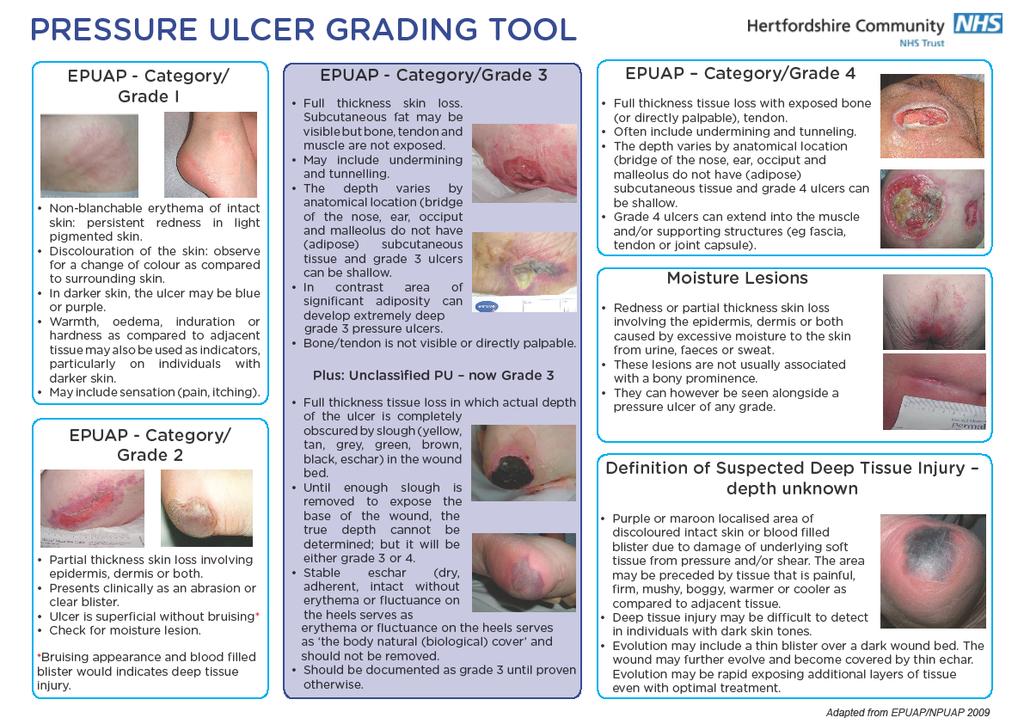 APPENDIX 5: Pressure Ulcer Classification Tool Pressure Ulcer