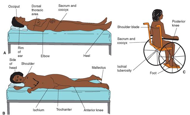 Figure1: Areas at risk of pressure damage Tissue damage may involve skin, subcutaneous tissue, deep fascia, muscle and bone 7.1 Risk Assessment 7.1.1 Initial and on-going risk assessment is the responsibility of a registered healthcare professional 7.