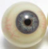 When will I get my artificial (prosthetic eye)?